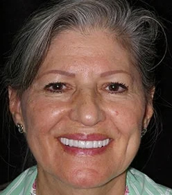 Joann's portrait after smile makeover