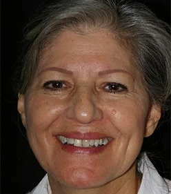 Joann's portrait before smile makeover