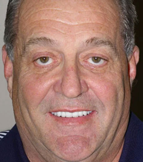 John's portrait after smile makeover