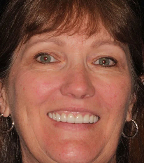 June's portrait after smile makeover